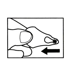 Lee Valley Set Of 3 Tick Key Tick Removers