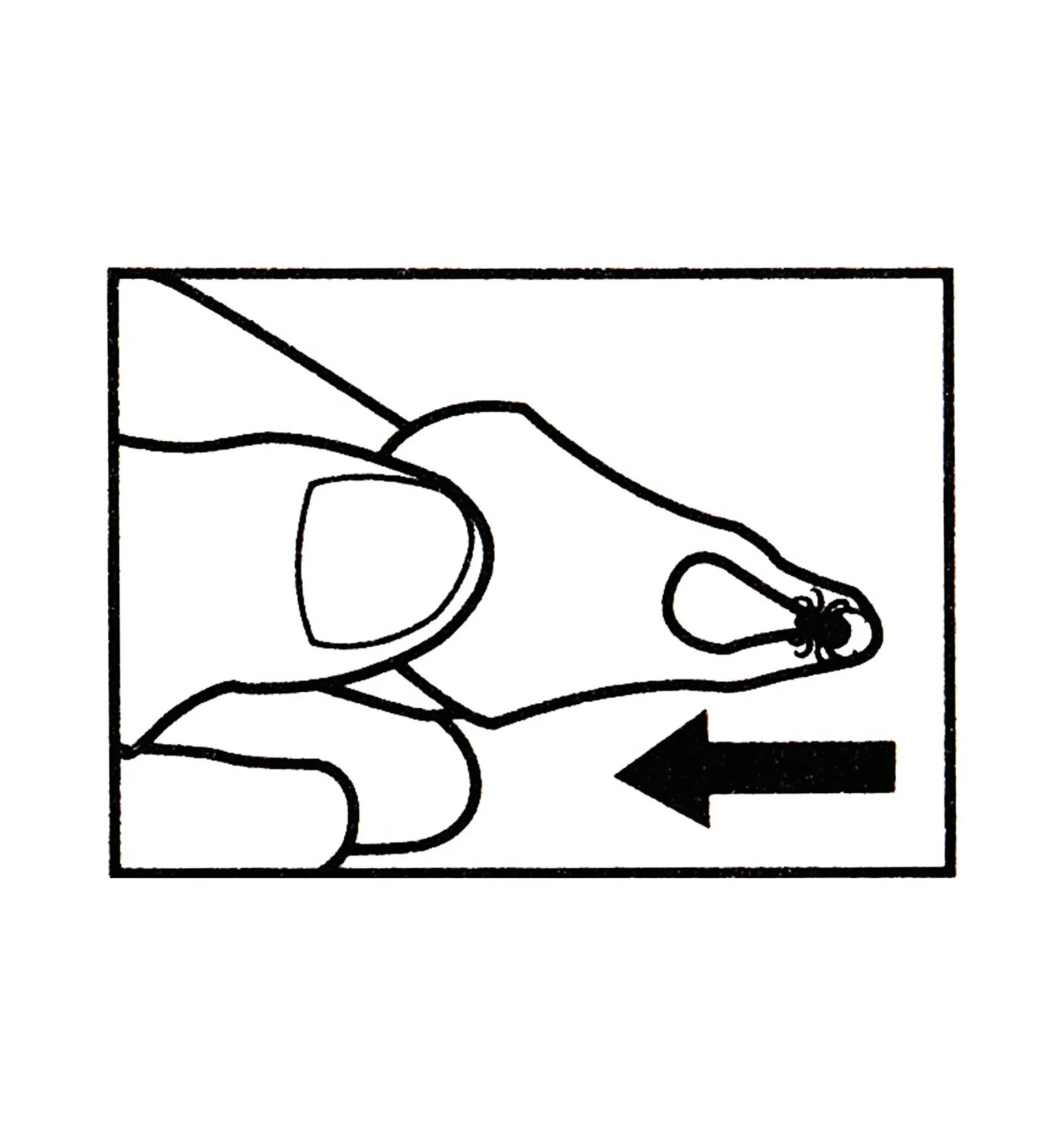 Lee Valley Set Of 3 Tick Key Tick Removers