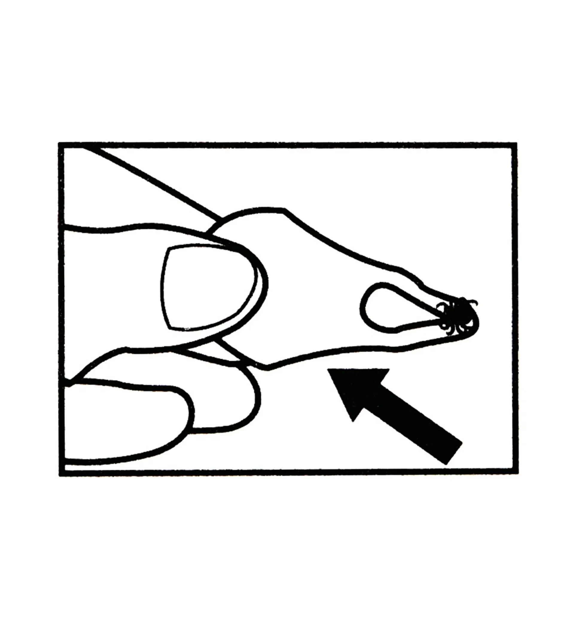 Lee Valley Tick Key Tick Remover